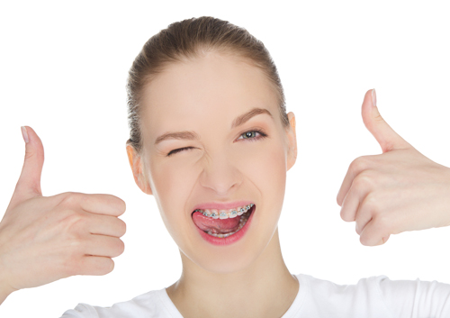 Five Fun Ways to Count Down Your Braces Time