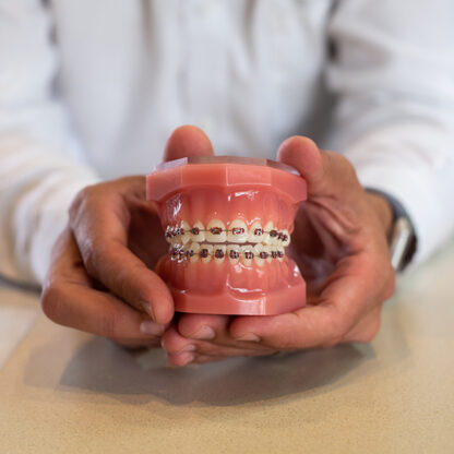 What is the difference between clear braces and clear aligners?